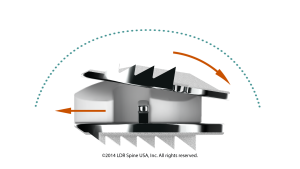 Mobi-c Spine Total Disc Replacement