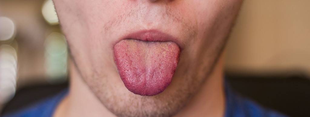 numb tongue