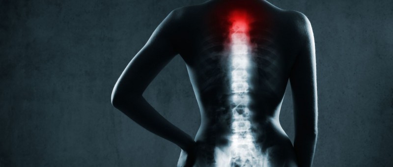 spinal nerve pain