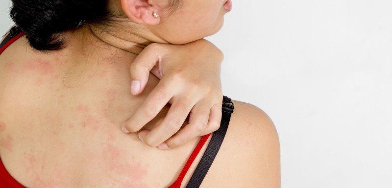 how-to-get-rid-of-itchy-and-irritated-skin-how-to-cure-itchy-skin