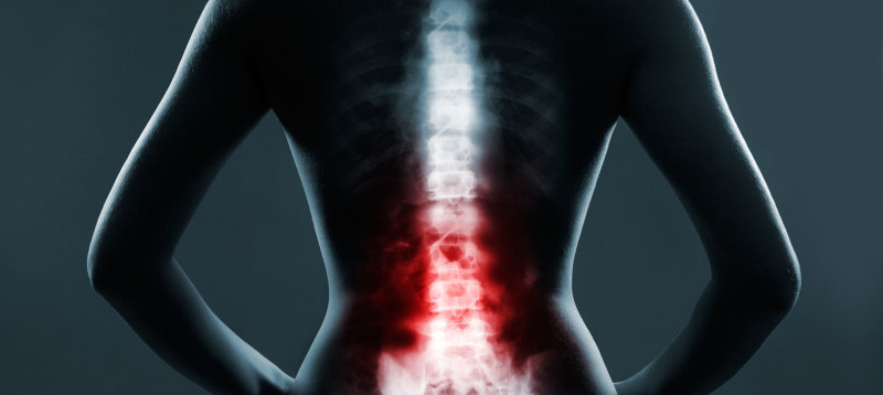 what-does-multilevel-spinal-degenerative-disc-disease-mean