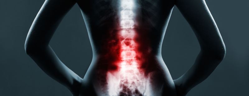 Laser Spine Surgery Risks