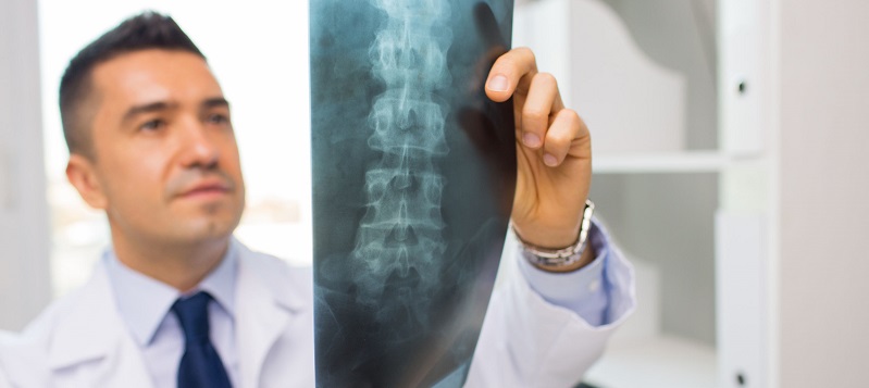 Spine Surgery Insurance