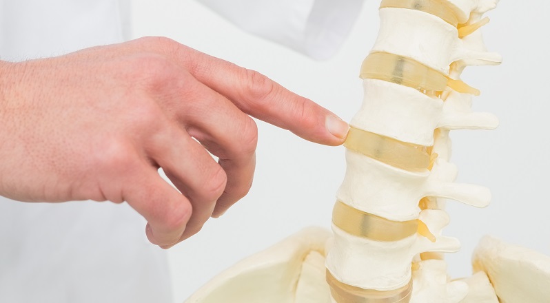 Psoriatic Arthritis of the Spine