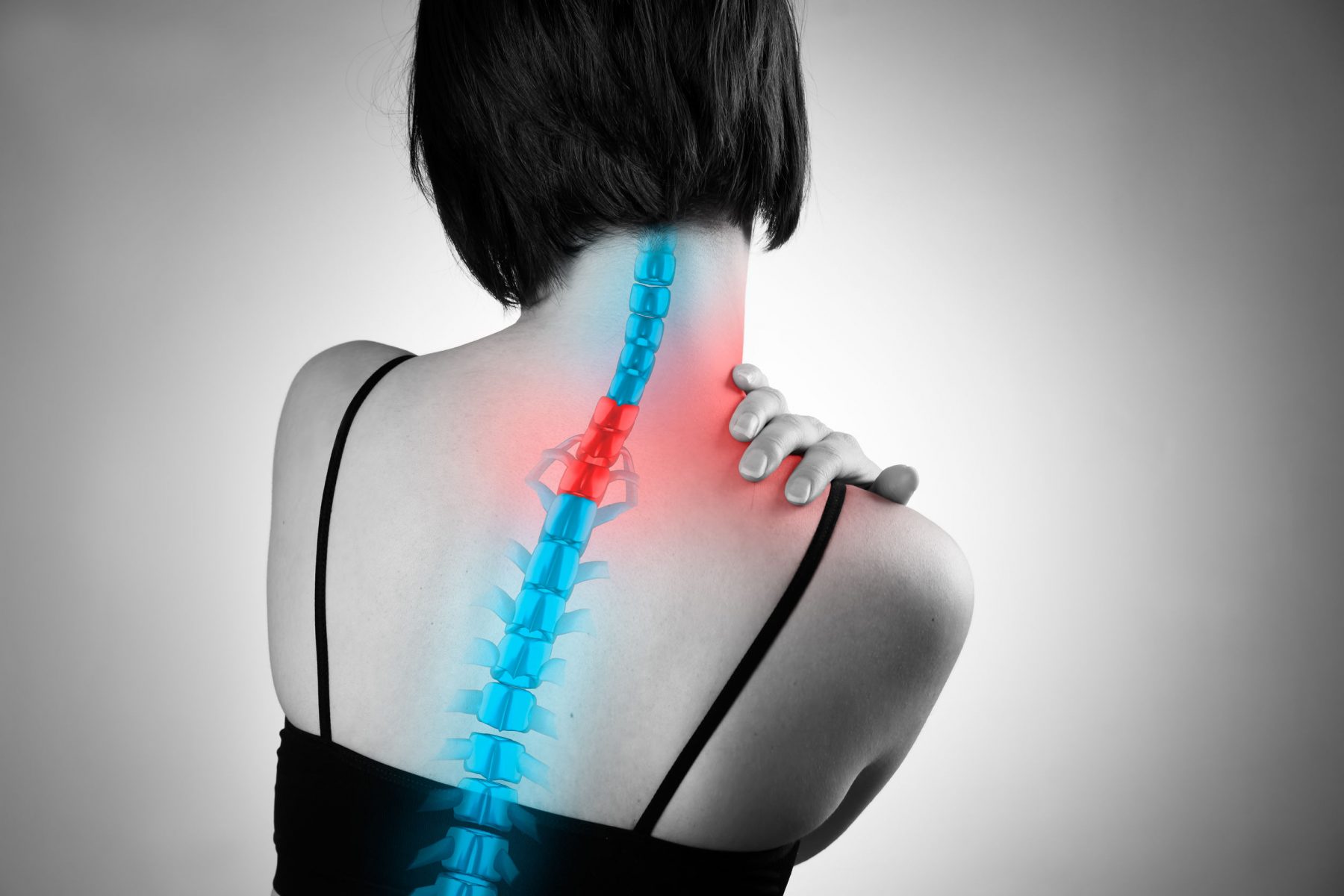 Spinal Retrolisthesis